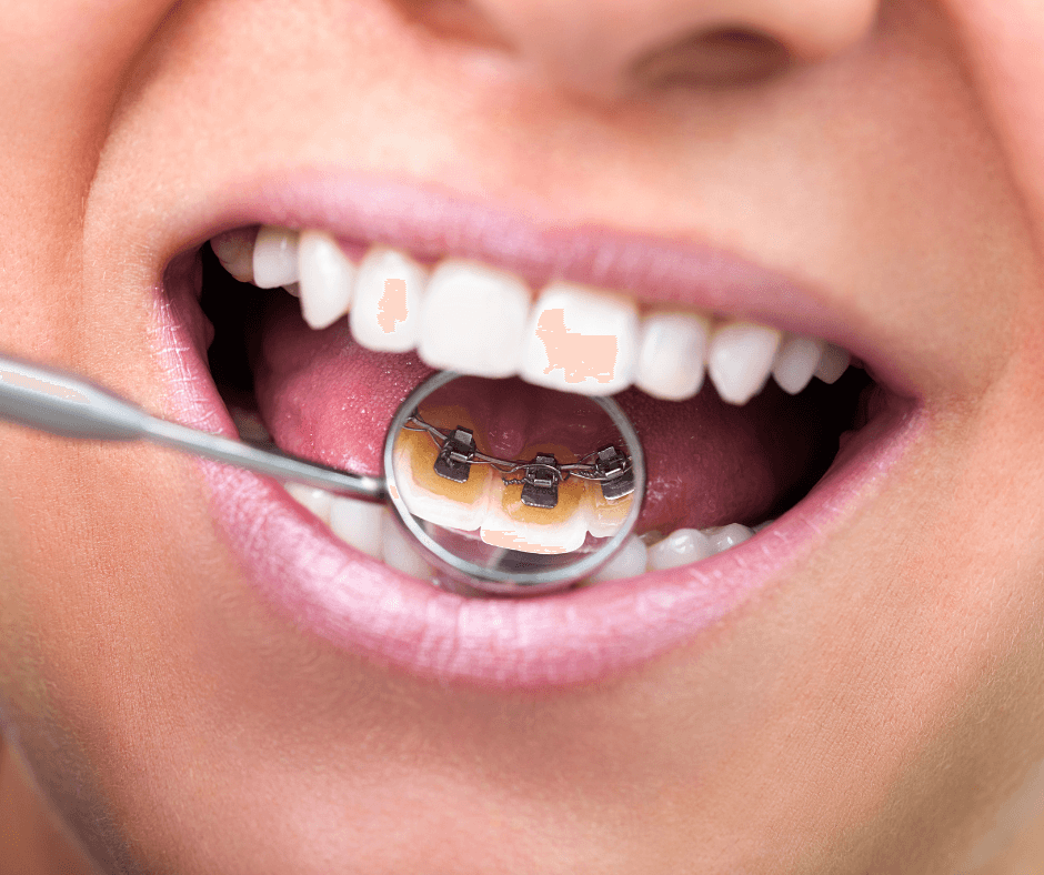 Banner Content Image