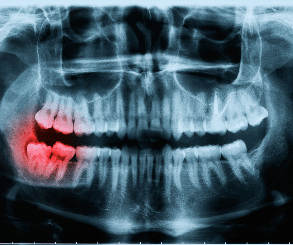 Banner Content Image