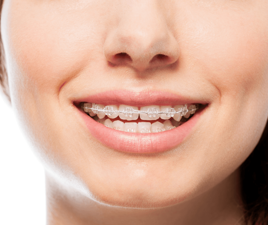 Banner Content Image