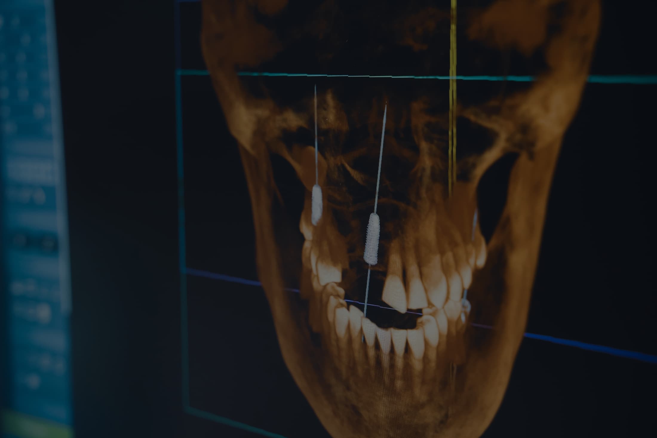 Banner Content Image